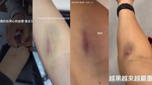 简奇升在社群媒体公开被抽血的影片