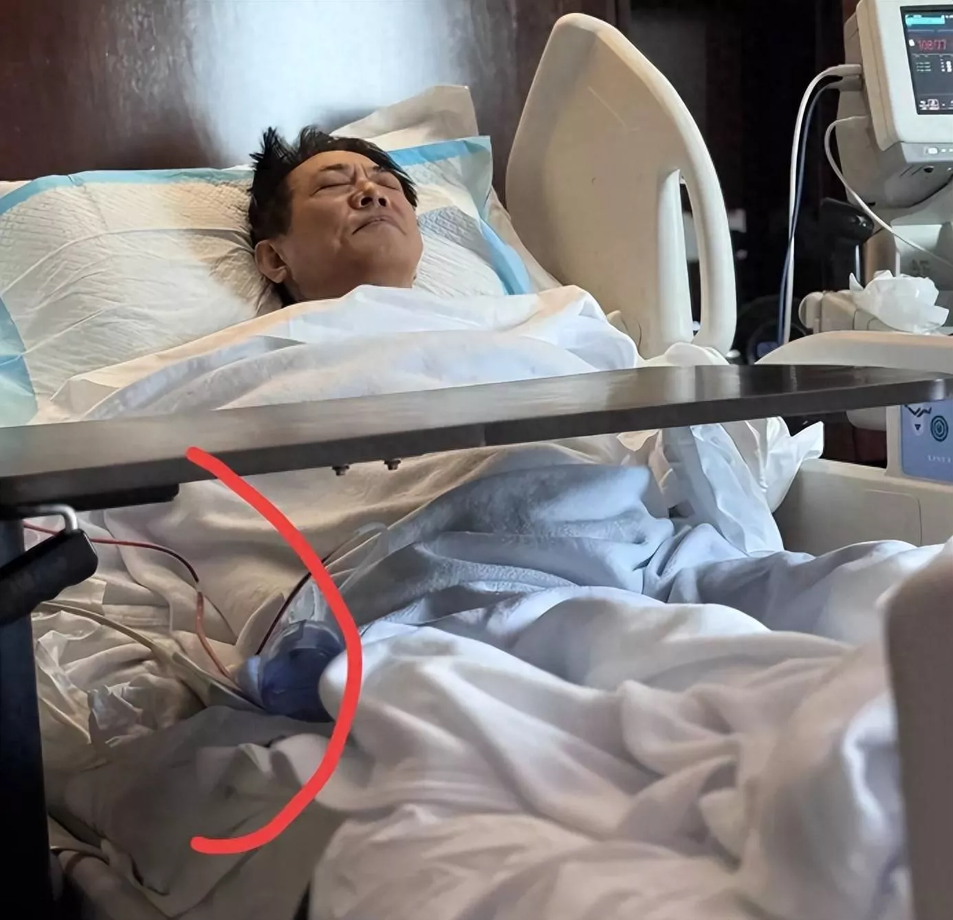 李连杰手术过程曝光价值两亿佛珠不离手，报平安才肯摘下