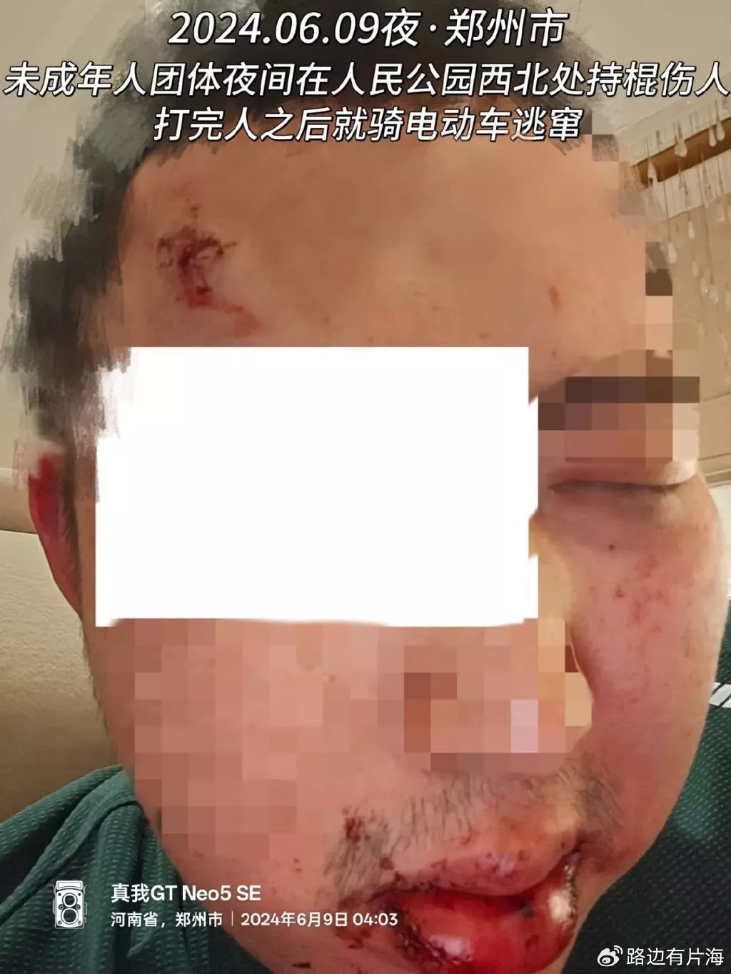 郑州围殴同性恋案:拉拉女卧底取证 却被拘留至今
