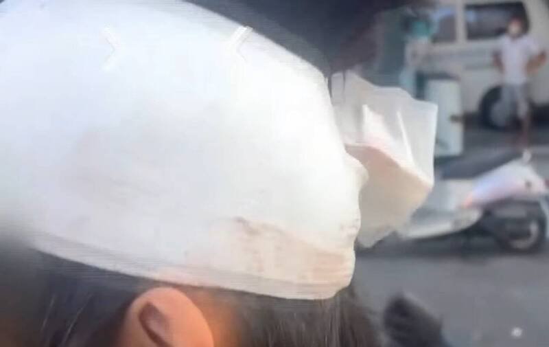 黄男今天傍晚出院时头部仍包扎纱布。(民众提供) 黄男今天傍晚出院时头部仍包扎纱布。(民众提供)
