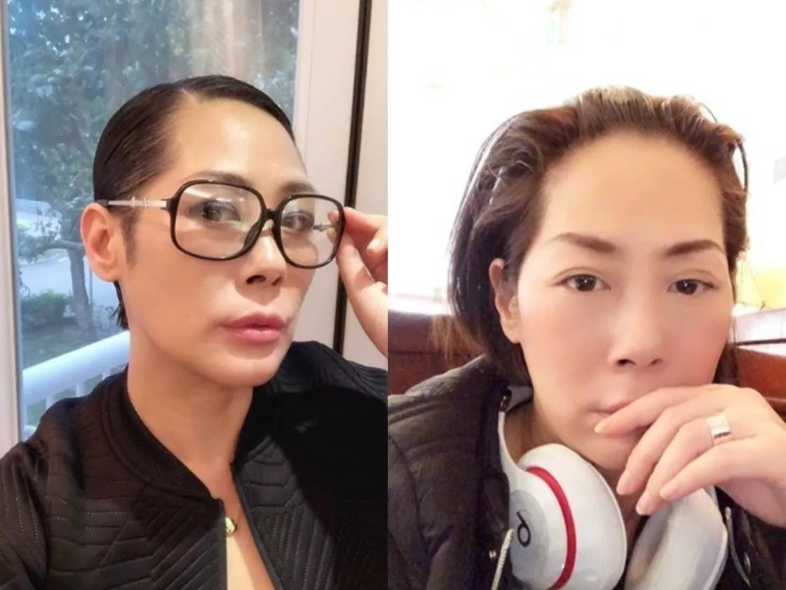 同是50+女星:叶倩文有活力，为何关淑怡却全身插管