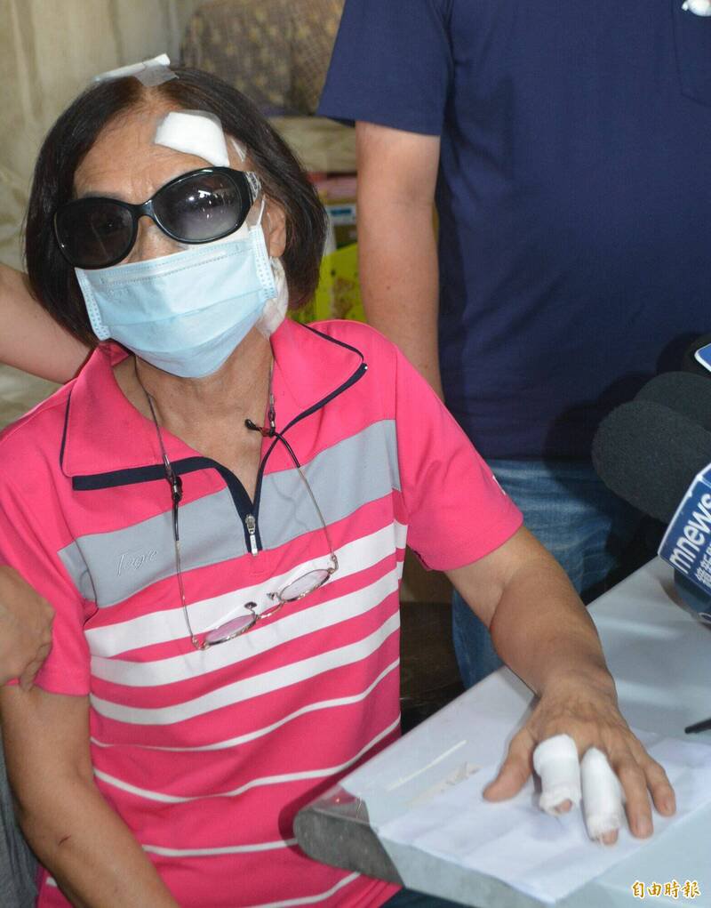 台中雾峰被砍的陈姓妇人,脸部、额头、手指头仍包著纱布。(记者陈建志摄) 台中雾峰被砍的陈姓妇人,脸部、额头、手指头仍包著纱布。(记者陈建志摄)