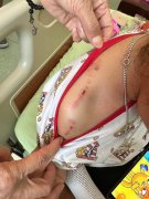 三义木雕街黑狗突冲出店家 2女童遭咬伤送医