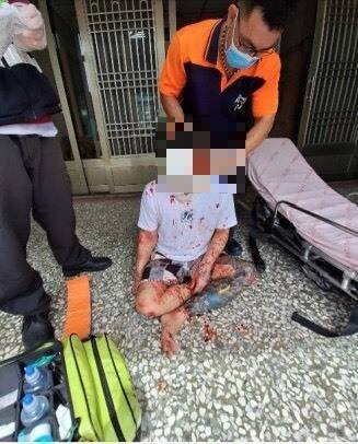 吴男脚骨折满身是血。（民众提供）