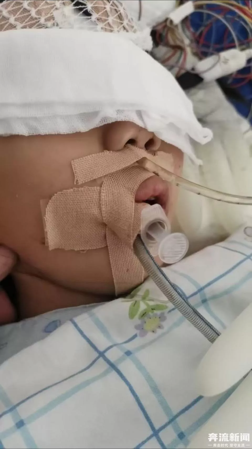 9岁女童术后成了植物人，医院多科室医护人员篡改病历