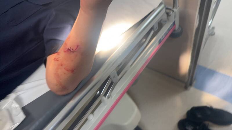 1名员警左手臂擦伤，就医缝了3针。（图由民众提供）