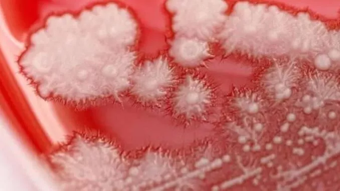 中国男子感冒乱吃药 喉咙长满雪花 吓坏医生