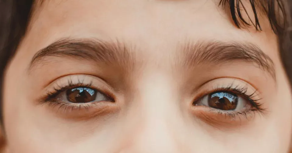 7岁女儿已失明！西班牙狠母还想弄瞎2岁儿