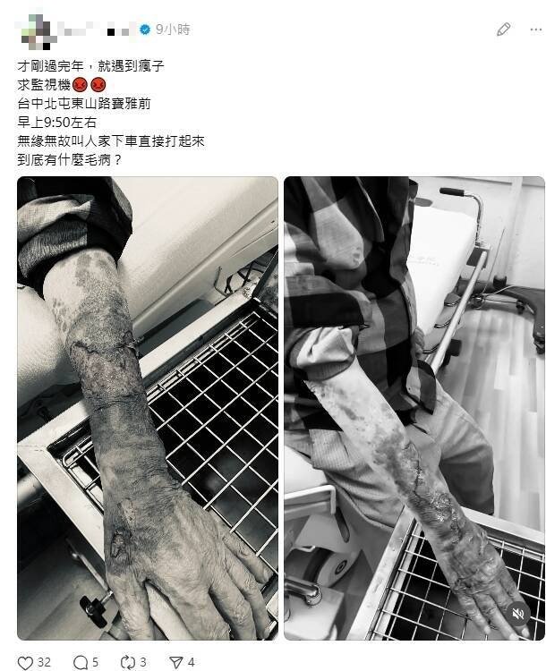 王姓老翁被打到手部严重受伤。（民众提供）